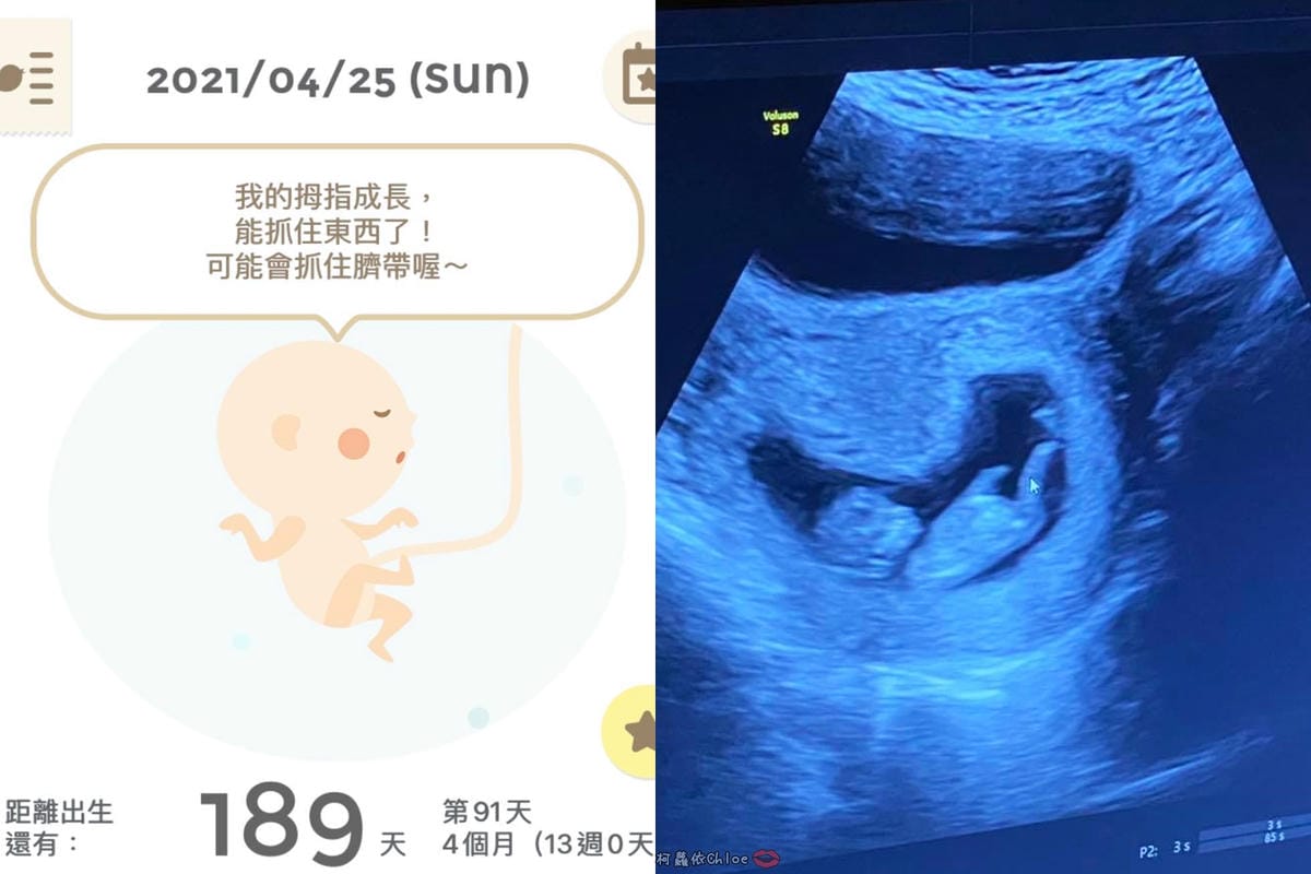 懷孕中期(13W~)營養補給品分享 孕哺兒 新維他命、珊瑚鈣膠囊1.jpg 懷孕中期(13W~)營養補給品分享 孕哺兒 新維他命、珊瑚鈣膠囊1.jpg