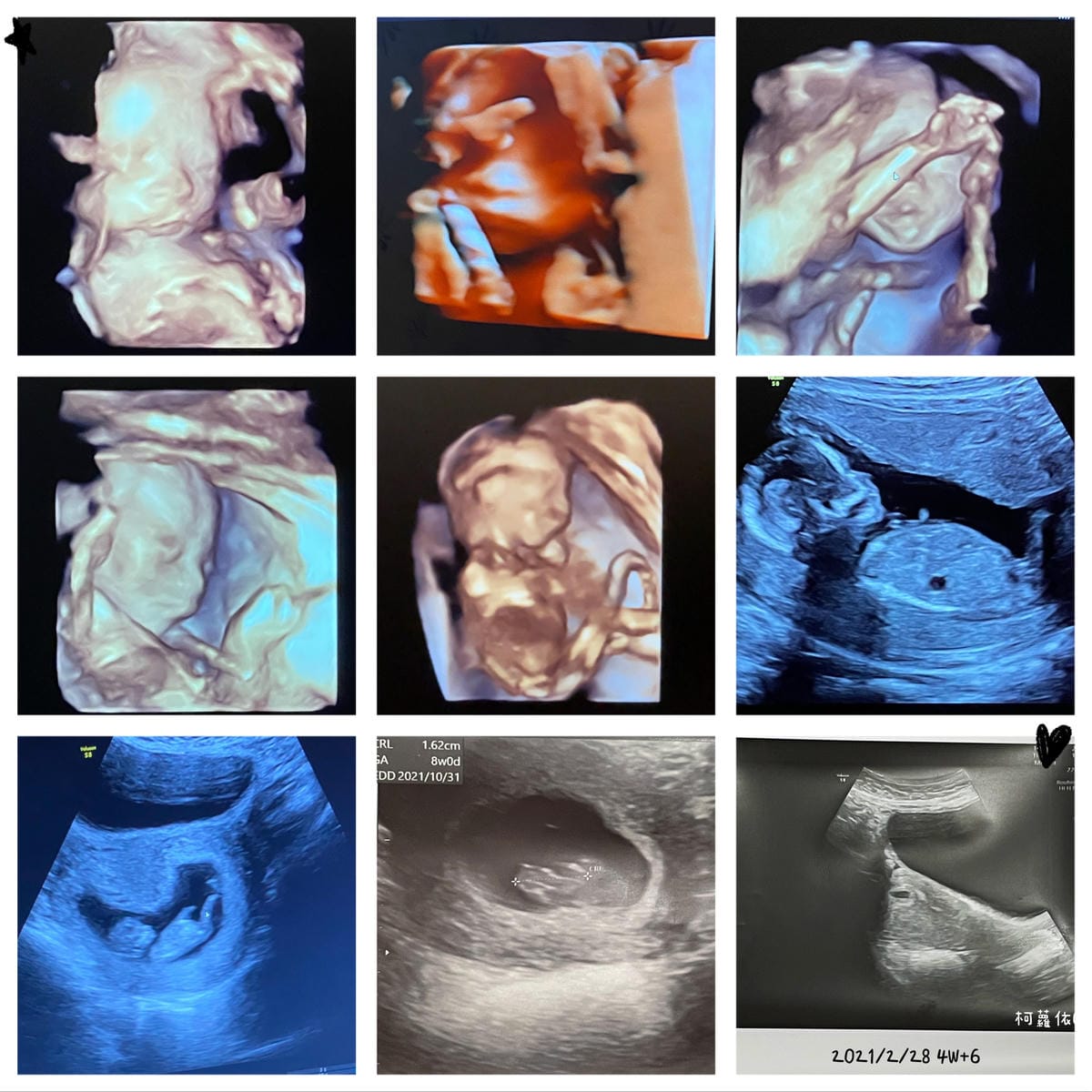 孕後期營養補充吃哪些 孕哺兒 媽媽藻油DHA 凍晶鐵+葉酸膠囊2.jpg 孕後期營養補充吃哪些 孕哺兒 媽媽藻油DHA 凍晶鐵+葉酸膠囊2.jpg
